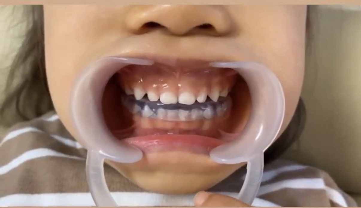 子どもが遊んでいる様子